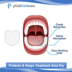 Dental Dry Angles Saliva Absorbent Pads – Parotid Shield Moisture Control (S/L)