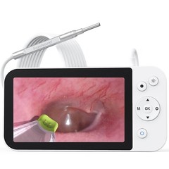 ScopeAround Ear Cleaning Camera Digital Otoscope Ear Camera with Ear Wax Removal