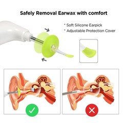 MOBI Otoscope Ear Cleaning Accessory Kit, Compatible with MOBI Smart Otoscope…