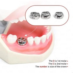 48 Sizes Dental Kids Primary Molar Crowns Stainless Steel Pediatric Crown Kit