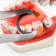 Dental Matrix Bands Ring Sectional Matrice Clamp Wedges Fit Palodent V3 System