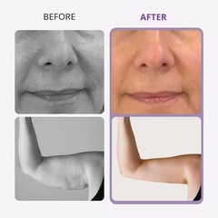 9 in 1 Beauty Machine for Body Massage Facial Skin Care Skin Lifting Lost WeigkY
