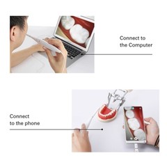 Dental Intraoral Camera USB HD Camera Oral Endoscope 8 LED Lights 3-speed Adjust
