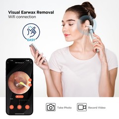 MOBI Otoscope Ear Cleaning Accessory Kit, Compatible with MOBI Smart Otoscope…