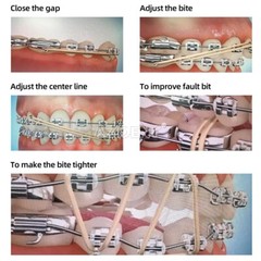 AZDENT Dental Orthodontic Elastics latex Rubber Bands/Roth/MBT 0.022 Buccal Tube