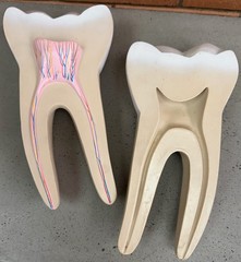 Vintage Education Resin Tooth Model Dental Human Body Bone Modern Cross-Section