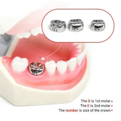 48 Sizes Dental Kids Primary Molar Crowns Stainless Steel Pediatric Crown Kit