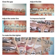 AZDENT Dental Orthodontic 3.5 5.0 6.5 OZ Elastics Rubber Bands Ortho Latex Brace