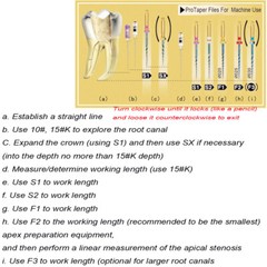 Dental Endodontic Engine Use Root Canal Endo Niti Rotary Files SX-F3 21/25/31mm