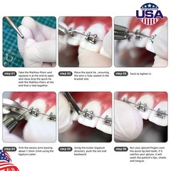 Dental Ligature Ties Orthodontic Wire Preformed Long Short Stainless Steel 100pc