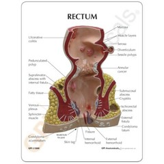 Rectum Anatomical Model GPI LFA #3350 SEE VIDEO