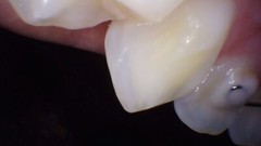 PerfectCam HD Intraoral Camera, USB Dental Camera, Free Capture Button Software.