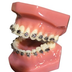 AZDENT Dental Ortho Brackets Brace Self-Ligating Active Mini Roth 022 Hooks 345