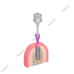 Dental Straumann Healing Abutments Closure Cover Screws NC/RC Fit ITI