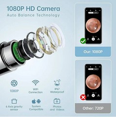 Wireless Ear Wax Removal Camera – Ear Wax Removal Tool Camera – Ear Wax Removal