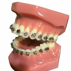 AZDENT Dental Ortho Brackets Brace Self-Ligating Active Mini Roth 022 Hooks 345