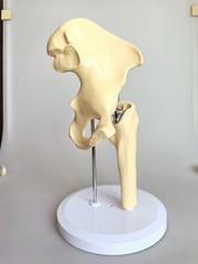 Artificial 1:1 Size Hip Joint Replacement Medical Anatomical Skeleton Model