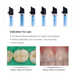 Dentex Dental Universal A1 A2 A3 A3.5 B1 B2 Recambio de Resina Compuesta de Foto