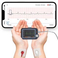 Home EKG Monitor with External Cable, 30s/60s/5min Recording + AI ECG Analysis