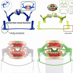 Dental Ortho Nola Lip Cheek Retractor Dry Field System Mouth Opener Large/Small
